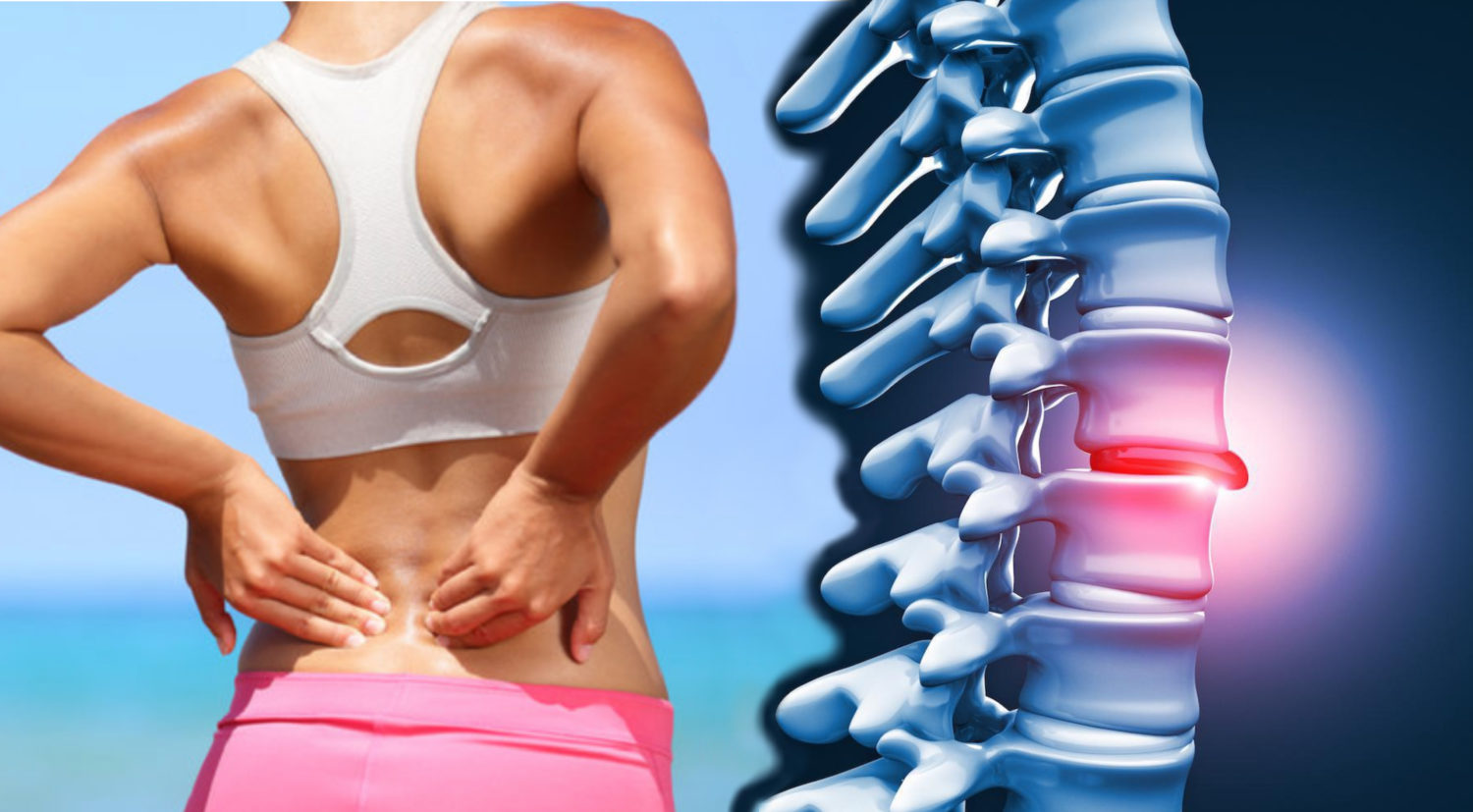 Here’s Why Your Herniated Disk Can Get Better